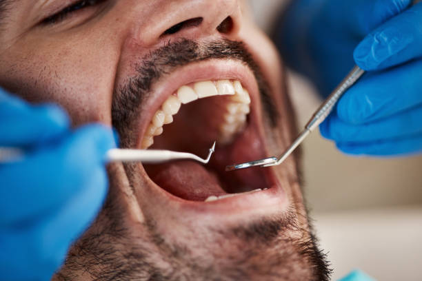 Best Emergency Dental Care for Abscessed Tooth in Fivepointville, PA